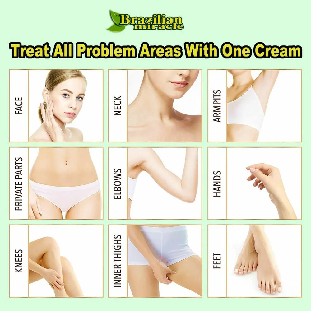 Anti Melasma‎ Cream Dark Spots Age Spots Freckles